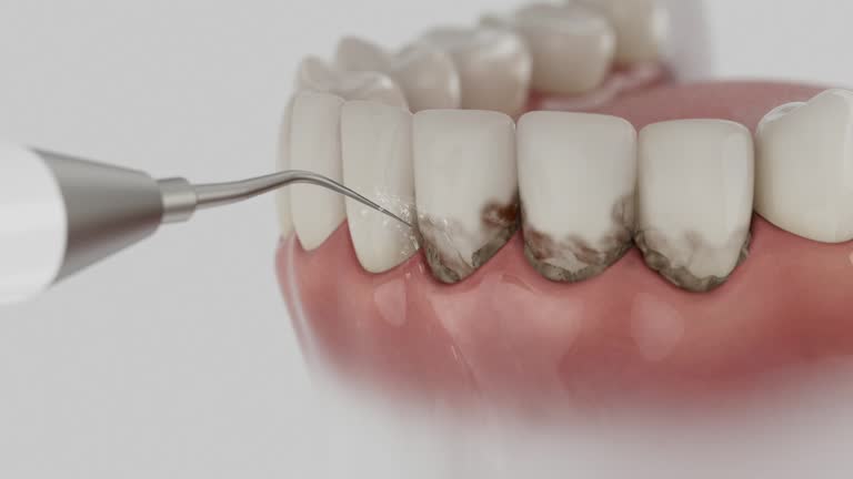Trusted Root Canal Treatment service in Shippensburg University, PA - Dentist Open Now